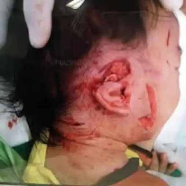Photos: Family dog attacked toddler savagely